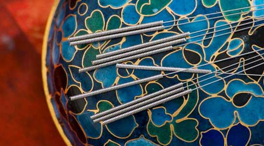 Acupuncture and Oriental Medicine