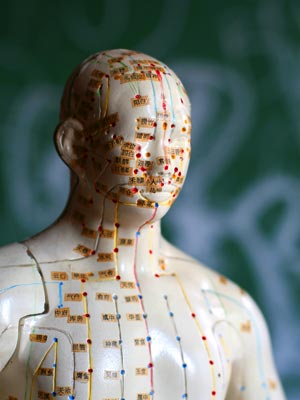 Acupuncture and Oriental Medicine