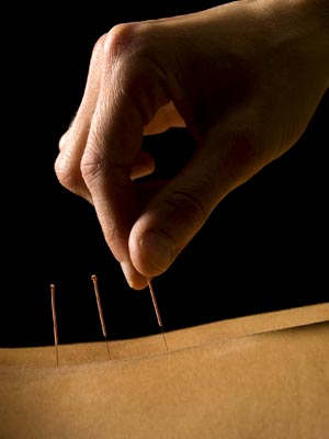 Acupuncture and Oriental Medicine