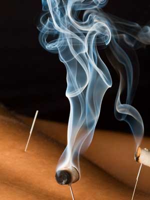 Acupuncture, Richmond, Virginia, Acupuncture Pain Managment