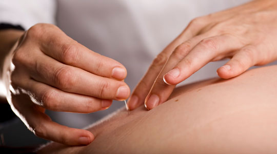 Acupuncture and Oriental Medicine