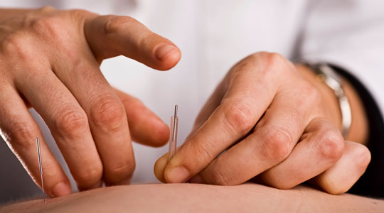 Acupuncture and Oriental Medicine