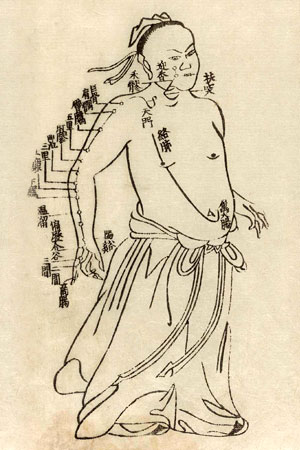 Acupuncture and Oriental Medicine