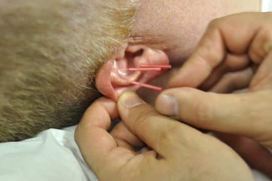 Acupuncture and Oriental Medicine